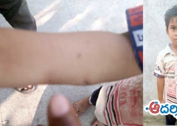 అంగన్వాడీ చిన్నారికి విద్యుత్ షాక్